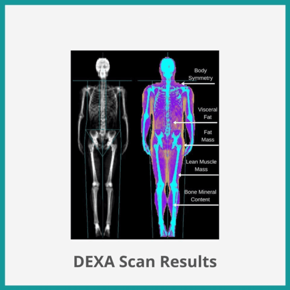 Dexa Scan Nayab Labs Islamabad