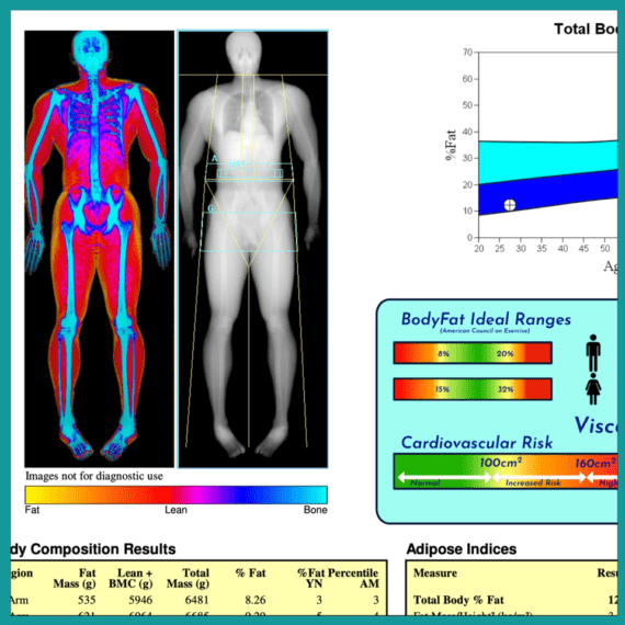 Dexa scan Reports