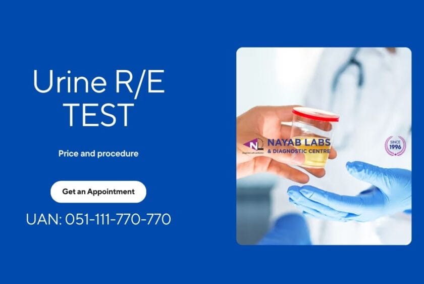 Urine R/E Test