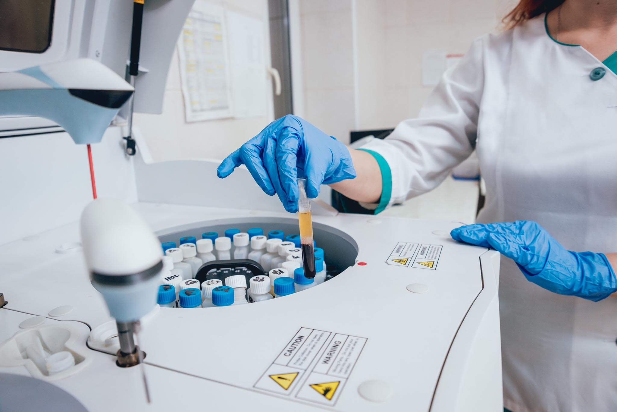 Laboratory Investigations - Nayab Labs and Diagnostic Centre