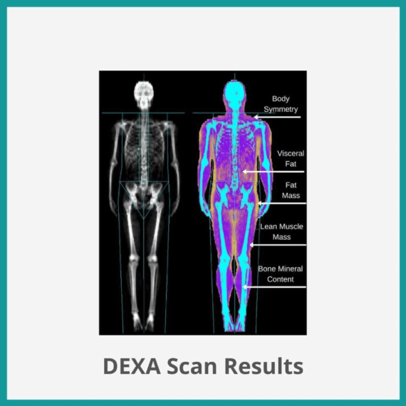 Dexa Scan Nayab Labs Islamabad