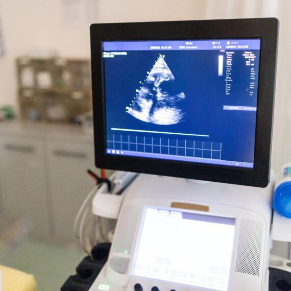 Echocardiographo