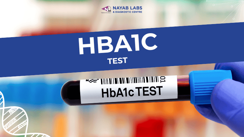 HBA1c Test Price