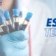 esr test price