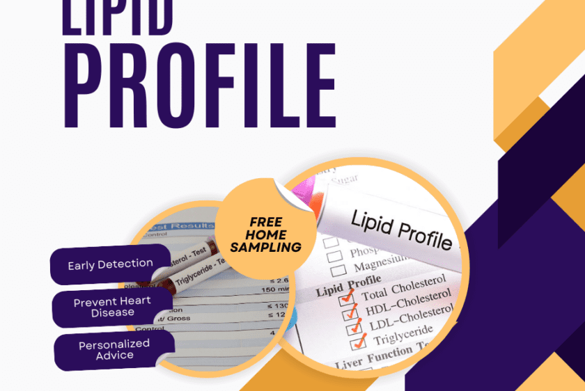 Lipid Profile Test