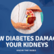 Diabetic kidney disease