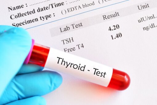Thyroid Test in islamabad