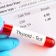 Thyroid Test in islamabad