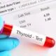 Thyroid Test in islamabad