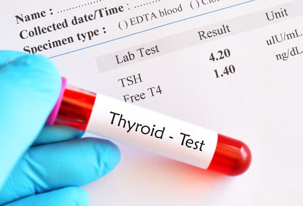 Thyroid Test in islamabad
