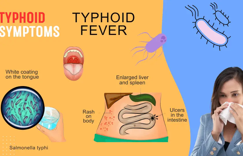 typhoid symptoms