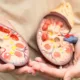 Creatinine test