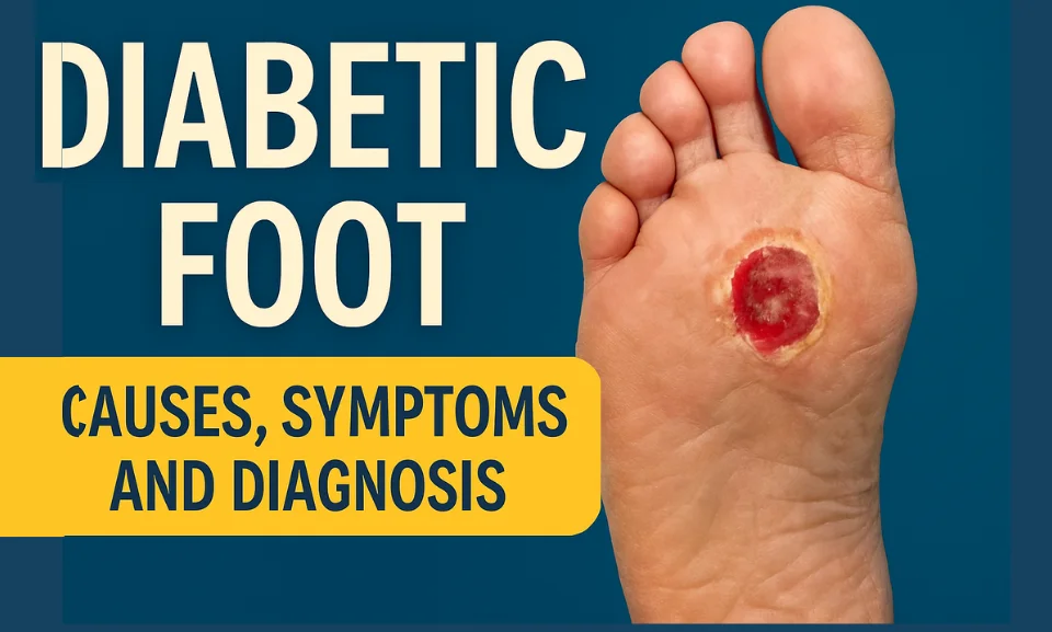 Diabetic Foot