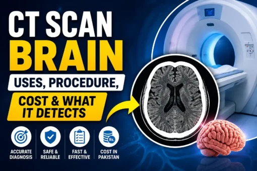 ct brain